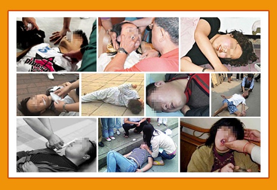 【成都癲癇病醫院】10月20-21日，北京專家蒞臨成都免費親診，還可申請免費專項檢查與治療援助!